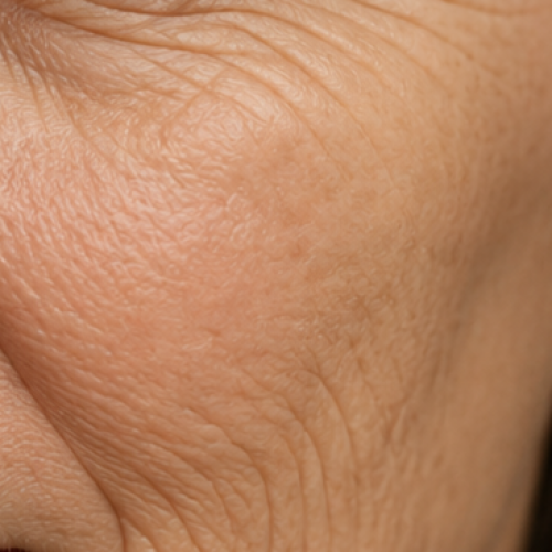 wrinkles wrinkles